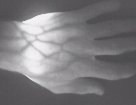 Historical infrared image of a hand